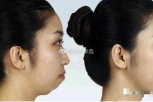 下巴长怎么（下巴长怎么变短）