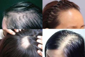 女生掉头发很厉害是什么原因（女生掉头发很厉害是什么原因引起的）