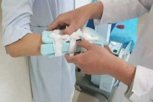 夹板的使用方法,骨折固定夹板怎么使用