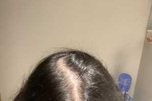 头发比较稀疏怎么办（头发比较稀疏怎么办女生）
