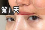 脸粗糙毛孔粗大怎么办（脸粗糙毛孔粗大怎么办）