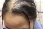 一直掉头发什么原因,头发怎么老掉头发