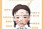 女性怎么样祛痘（女性怎么样祛痘最有效）