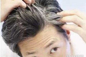 刚长白头发要如何改善,长白头发怎么办16