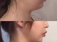 手机下巴宽是指什么,什么是宽下巴和窄下巴