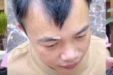 m发型怎么办（m型发型怎么办）
