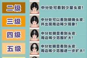 发量是什么（发量标准）