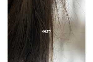 为什么发尾头发特别少,为啥头发稀少