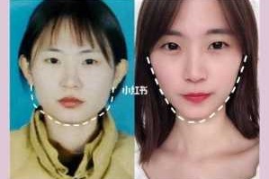我是一个国字脸如何瘦脸比较好,国字脸怎么变小脸图片
