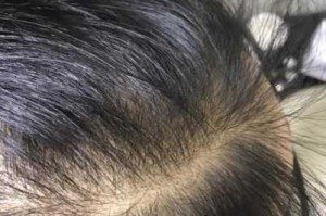 头发越来越少是什么原因（头发越来越少是什么原因造成的）
