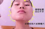 脸很扁平怎么办,扁脸是怎么造成的