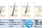 毛囊怎么样才能长新发,怎么长出新发