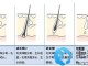毛囊怎么样才能长新发,怎么长出新发