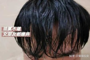 发质不好怎么改善,男生发质不好怎么改善