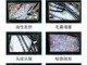 怎么检查头发（怎么检查头发毛囊是否闭合）