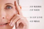 怎么去掉眼角的皱纹（眼角皱纹怎么改善）