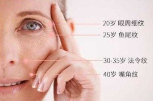 怎么去掉眼角的皱纹（眼角皱纹怎么改善）