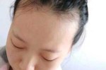 额头前头发少怎么办（额头前头发少怎么办女）