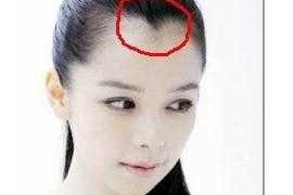 美人尖是什么样子（美人尖是什么样子图片）