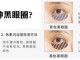 什么去黑眼圈（怎么去黑眼圈）