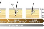 洗头掉头发什么原因（洗头掉头发什么原因,正常吗）