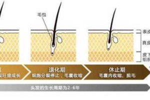 洗头掉头发什么原因（洗头掉头发什么原因,正常吗）