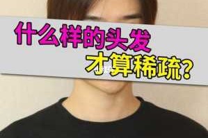 头发稀少怎么（头发稀少怎么变浓密）
