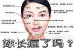 脸上长痘痘粉刺是什么原因（脸上长痘痘粉刺是什么原因）