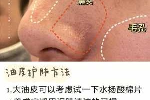 去黑头有什么好办法（去黑头有什么好办法吗）