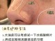 去黑头有什么好办法（去黑头有什么好办法吗）