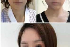 什么样是脸骨大（什么是颌骨和颧骨）