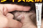 头皮瘙痒怎么治疗（头皮发痒,头上起包是什么病,用什么药好）