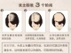 什么原因造成脱发（什么原因造成脱发严重）