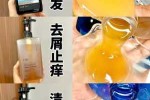 头发出油而且掉头发挺严重用什么洗发水,头皮出油脱发用什么洗发水好