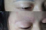 如何祛除脸上的雀斑,雀斑用什么洗