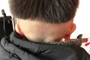 头发伤的厉害怎么办（头发太抛了怎么办）