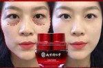 去眼袋什么好（去眼袋什么好用）