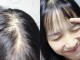 总掉头发怎么办,女生头发掉的多怎么办
