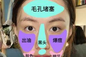 脸上毛细孔粗大该怎么办,脸毛细孔粗大解决方法