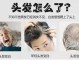 白发的原因是什么（白发的原因是什么）