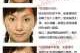 鼻子旁边长痘痘是什么原因,鼻子附近长痘痘是什么原因引起的