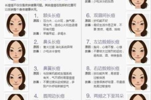 下颚两侧长痘的原因,下巴长痘怎么办才可以消除