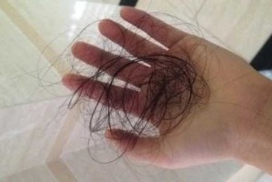 女生头发掉的厉害是什么原因（女生头发掉的厉害是什么原因怎么办）