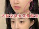 脸型太大怎样瘦,怎么样瘦脸型最有效