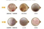 痘痘的什么（痘痘的什么）