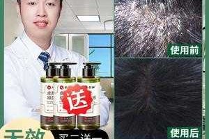 头发用什么洗好,头部银屑病用什么洗头发好
