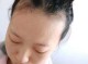 额头前面头发少怎么办（额头前面头发少怎么办女生）