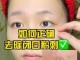 怎么去掉粉刺（去除粉刺闭口的方法）