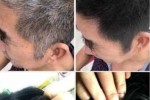白发是怎么回事,白发怎么变黑发怎么调理