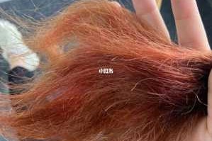 头发容易开叉什么原因（头发分叉是什么原因引起的）